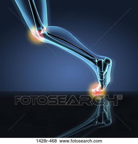 X-ray view of a human's leg showing pain in knee, ankle and foot in running position View Large Photo Image Stock Photo - X-ray view of a human's leg showing pain in knee, ankle and foot in running position. Fotosearch