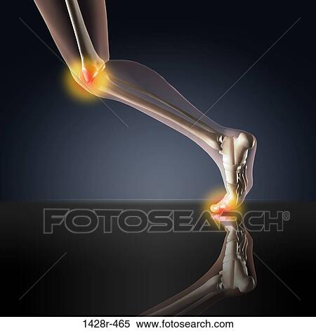 X-ray view of a human's leg showing pain in knee and ankle in running position View Large Photo Image Stock Photography - X-ray view of a human's leg showing pain in knee and ankle in running position. Fotosearch