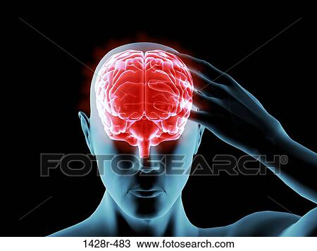 X-ray view of a man grabbing his head in pain View Large Photo Image Stock Image - X-ray view of a man grabbing his head in pain. Fotosearch