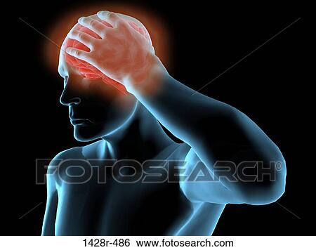 X-ray view of a man grabbing his head in pain View Large Photo Image Stock Photograph - X-ray view of a man grabbing his head in pain. Fotosearch