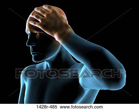 X-ray view of a man grabbing his head in pain View Large Photo Image Stock Photography - X-ray view of a man grabbing his head in pain. Fotosearch