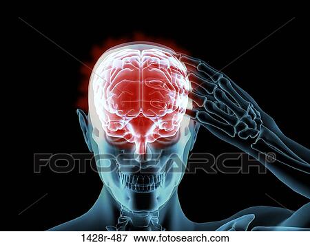 X-ray view of a man grabbing his skull in pain View Large Photo Image Stock Photo - X-ray view of a man grabbing his skull in pain. Fotosearch