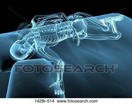 X-ray view of a woman sleeping View Large Photo Image Picture - X-ray view of a woman sleeping. Fotosearch
