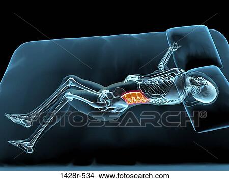 Picture - X-ray view of a woman sleeping showing inflammation in back. Fotosearch
