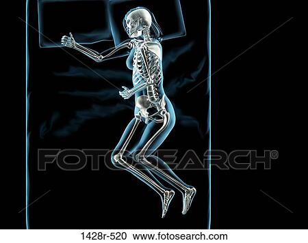Stock Image - X-ray view of a woman sleeping. Fotosearch