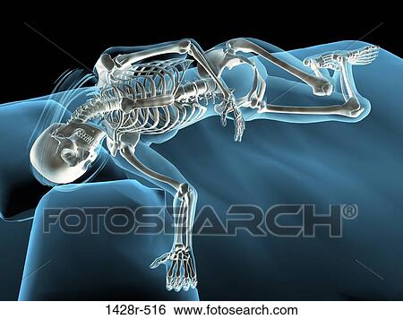 Stock Photograph - X-ray view of a woman sleeping. Fotosearch