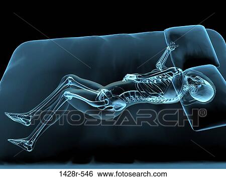 X-ray view of a woman sleeping View Large Photo Image Stock Photograph - X-ray view of a woman sleeping. Fotosearch