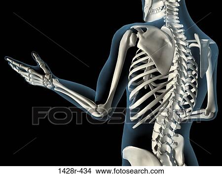 Picture - X-ray view of elbow bones in a see-through arm with hand and spinal bones. Fotosearch