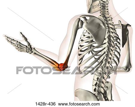 Stock Photograph - X-ray view of elbow joint red with inflammation in a see-through arm with hand and spinal bones. Fotosearch
