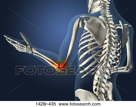 X-ray view of elbow joint red with inflammation in a see-through arm with hand and spinal bones View Large Photo Image Stock Photography - X-ray view of elbow joint red with inflammation in a see-through arm with hand and spinal bones. Fotosearch