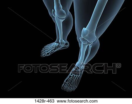 X-ray view of knees View Large Photo Image Stock Image - X-ray view of knees. Fotosearch