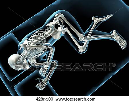 X-ray view of man sleeping View Large Photo Image Stock Image - X-ray view of man sleeping. Fotosearch