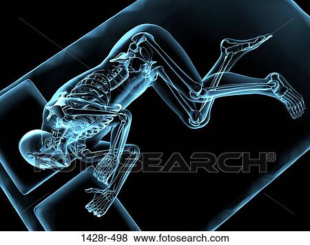 X-ray view of man sleeping View Large Photo Image Stock Photo - X-ray view of man sleeping. Fotosearch