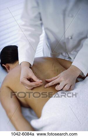 Chinese, patient, back, acupuncture, Middle-aged, accuracy View Large Photo Image Stock Image - Chinese, patient, back, acupuncture, Middle-aged, accuracy. Fotosearch
