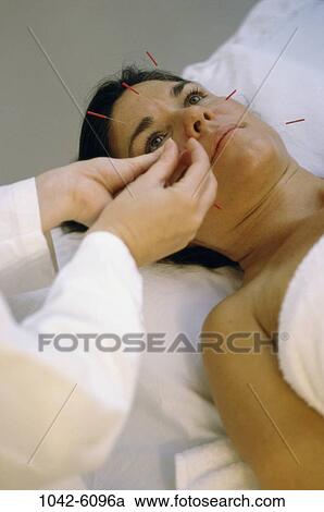 people, woman, patient, acupuncture, health, Middle-aged, alternative View Large Photo Image Stock Image - people, woman, patient, acupuncture, health, Middle-aged, alternative. Fotosearch