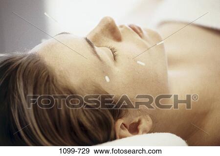 people, woman, acupuncture, health, alternative, brunette View Large Photo Image Stock Photo - people, woman, acupuncture, health, alternative, brunette. Fotosearch