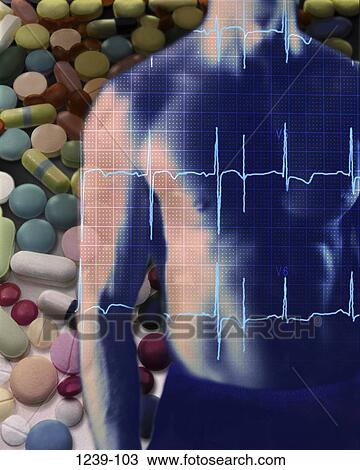 Stock Image - diet, health, pills, drugs, abdomen, heart monitor. Fotosearch