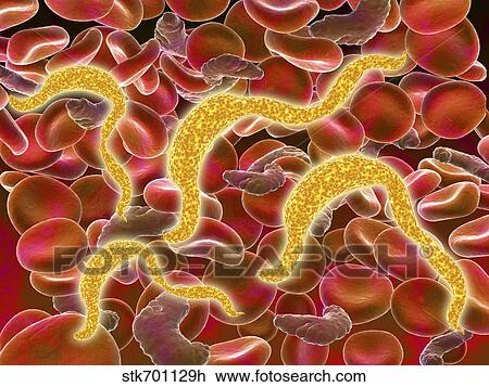 Drawing - African trypanosomiasis in the red blood cells.. Fotosearch