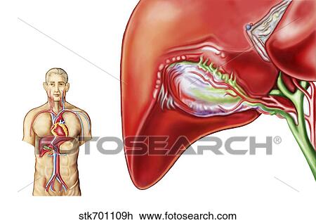 Drawing - Anatomy of gall bladder ganglion.. Fotosearch