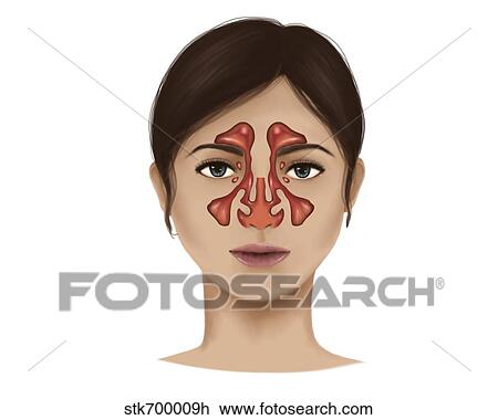 Drawing - Anatomy of nasal sinuses.. Fotosearch