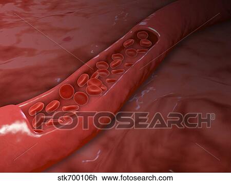 Artery cross section with red blood cell flow. View Large Illustration Drawing - Artery cross section with red blood cell flow.. Fotosearch