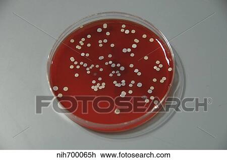 Bacteria from human skin grown on agar in the laboratory. View Large Photo Image Stock Image - Bacteria from human skin grown on agar in the laboratory.. Fotosearch