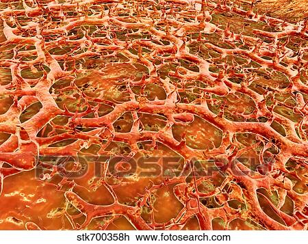 Close-up view of athlete's foot fungus. View Large Illustration Drawing - Close-up view of athlete's foot fungus.. Fotosearch