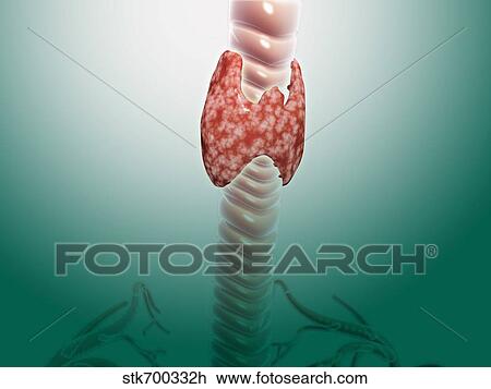 Drawing - Close-up view of thyroid gland.. Fotosearch