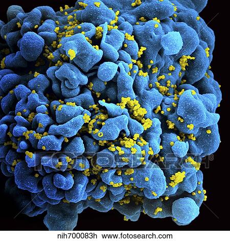 Colorized image of HIV-infected H9 T-cell. View Large Photo Image Stock Image - Colorized image of HIV-infected H9 T-cell.. Fotosearch