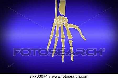 Drawing - Conceptual image of bones in human hand.. Fotosearch