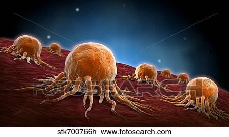 Conceptual image of cancer virus. View Large Illustration Drawing - Conceptual image of cancer virus.. Fotosearch