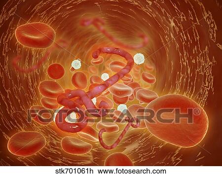 Drawing - Conceptual image of ebola virus in artery.. Fotosearch