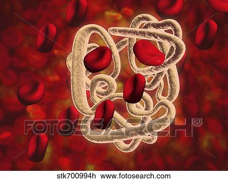 Conceptual image of hemoglobin and red blood cells. View Large Illustration Drawing - Conceptual image of hemoglobin and red blood cells.. Fotosearch
