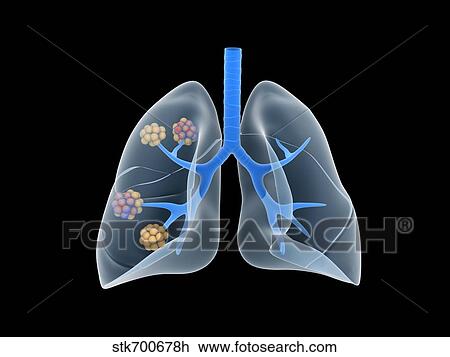 Drawing - Conceptual image of human lungs.. Fotosearch