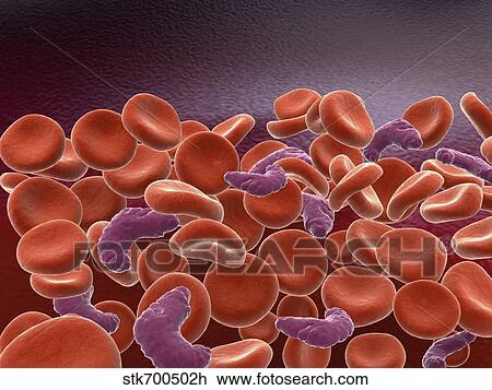 Drawing - Conceptual image of sickle cell anemia with red blood cells.. Fotosearch