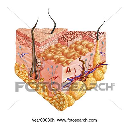 Detailed cutaway diagram of human skin. View Large Illustration Drawing - Detailed cutaway diagram of human skin.. Fotosearch