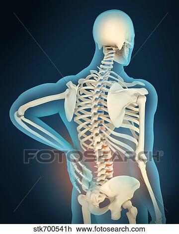 Medical illustration showing inflammation in human back area View Large Illustration Drawing - Medical illustration showing inflammation in human back area. Fotosearch