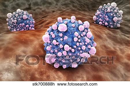 Drawing - Microscipic view of pancreatic cancer cells.. Fotosearch