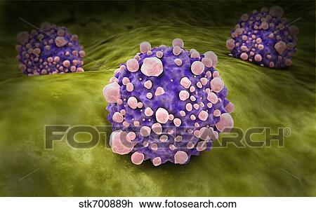 Drawing - Microscipic view of pancreatic cancer cells.. Fotosearch