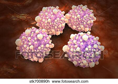 Drawing - Microscipic view of pancreatic cancer cells.. Fotosearch