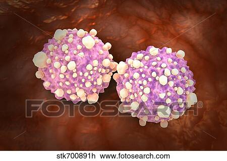 Drawing - Microscipic view of pancreatic cancer cells.. Fotosearch