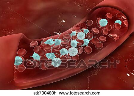 Drawing - Microscopic view of blood clotting inside the artery.. Fotosearch
