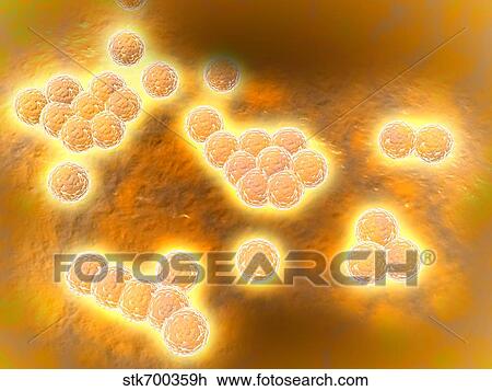 Drawing - Microscopic view of Methicillin-resistant Staphylococcus aureus.. Fotosearch