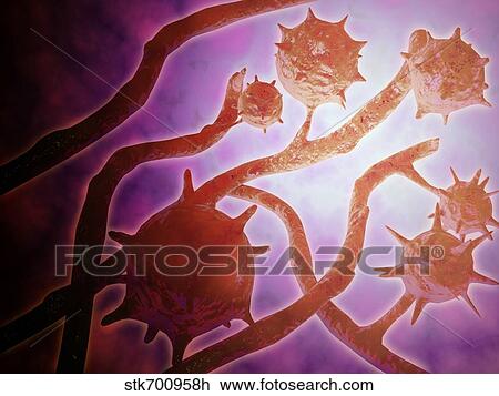 Drawing - Microscopic view of histoplasmosis.. Fotosearch