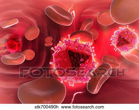 Drawing - Microscopic view of HIV virus inside the lungs.. Fotosearch