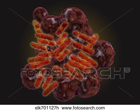 Drawing - Microscopic view of Rickettsia.. Fotosearch
