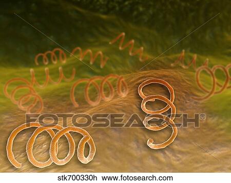 Drawing - Microscopic view of Syphillis.. Fotosearch