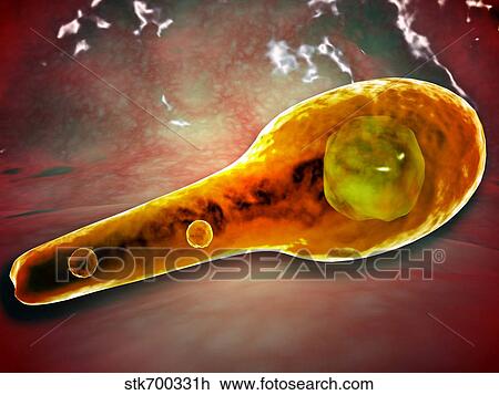 Drawing - Microscopic view of Tetanus.. Fotosearch