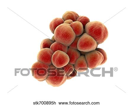 Drawing - Microscopic view of tumor.. Fotosearch
