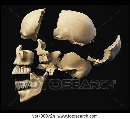 Side view of human skull with parts exploded. View Large Illustration Drawing - Side view of human skull with parts exploded.. Fotosearch